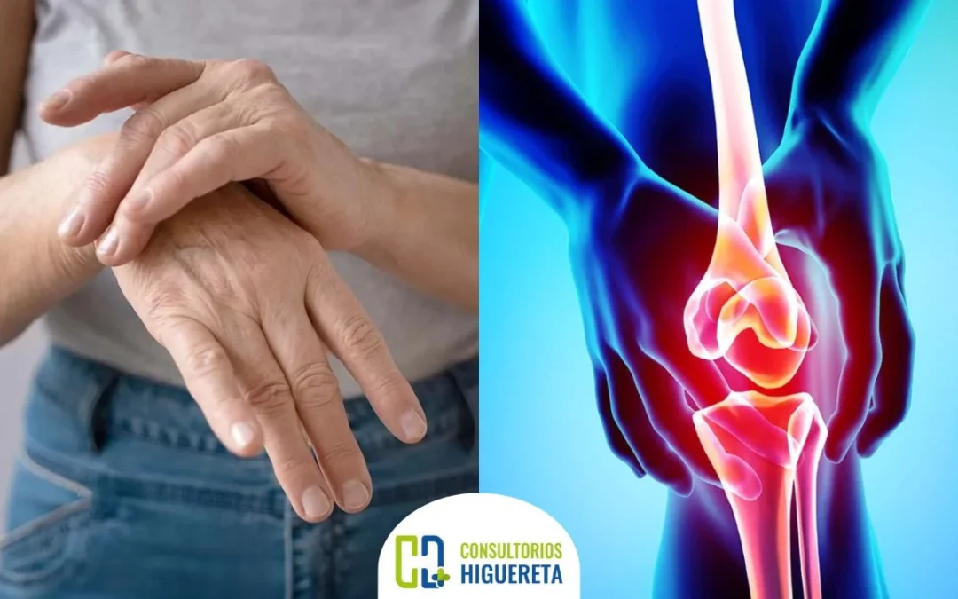 Remedios Naturales para Aliviar Dolores de la Osteoartritis de forma efectiva y sencilla